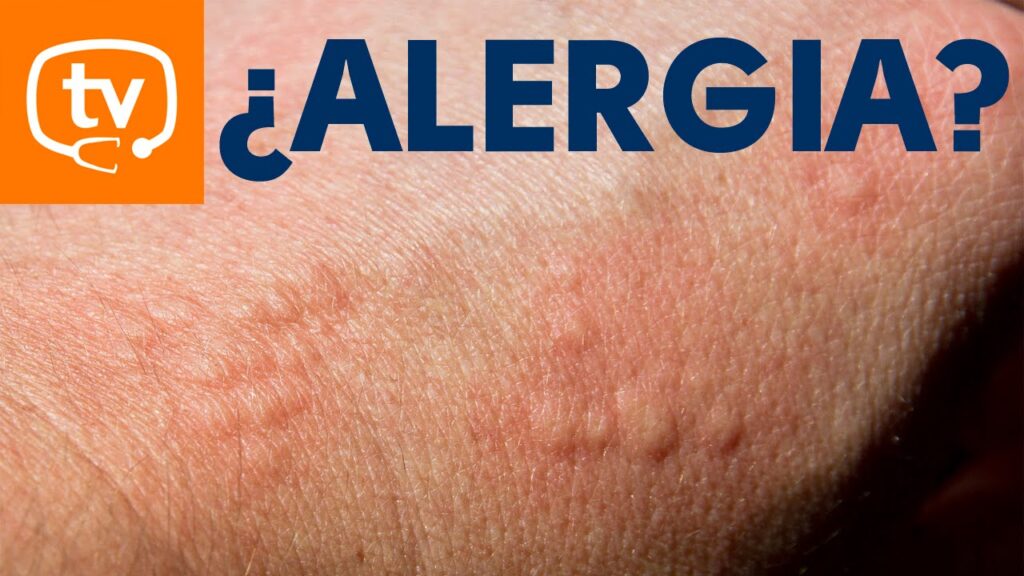 Nueva tendencia: alergia al polen en la piel causa sorpresa