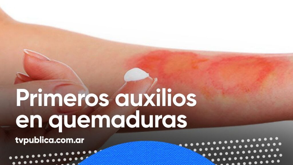 Nueva crema regeneradora: ¡Adiós a las quemaduras en tu piel!